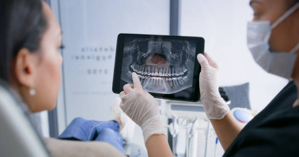 Licensed Tooth Extraction service in Lathrop, CA - Smile Center Dentistry